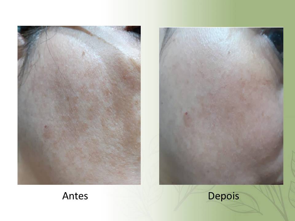 Sérum Facial Clareador e Antirugas