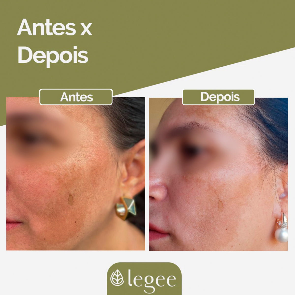 Sérum Facial Clareador e Antirugas
