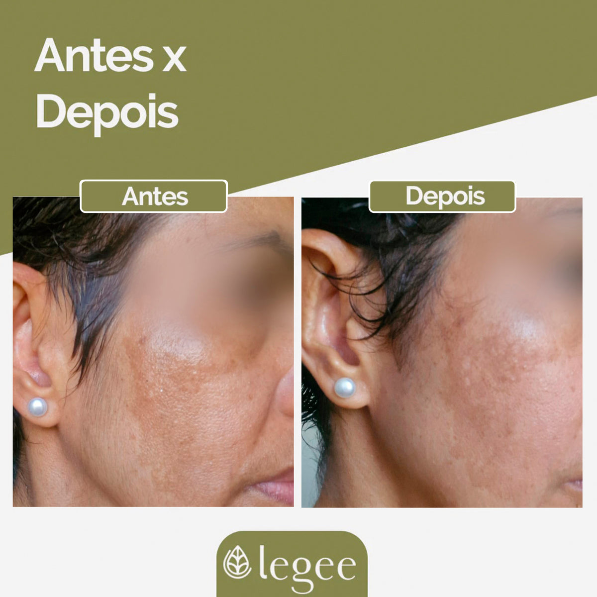 Sérum Facial Clareador e Antirugas