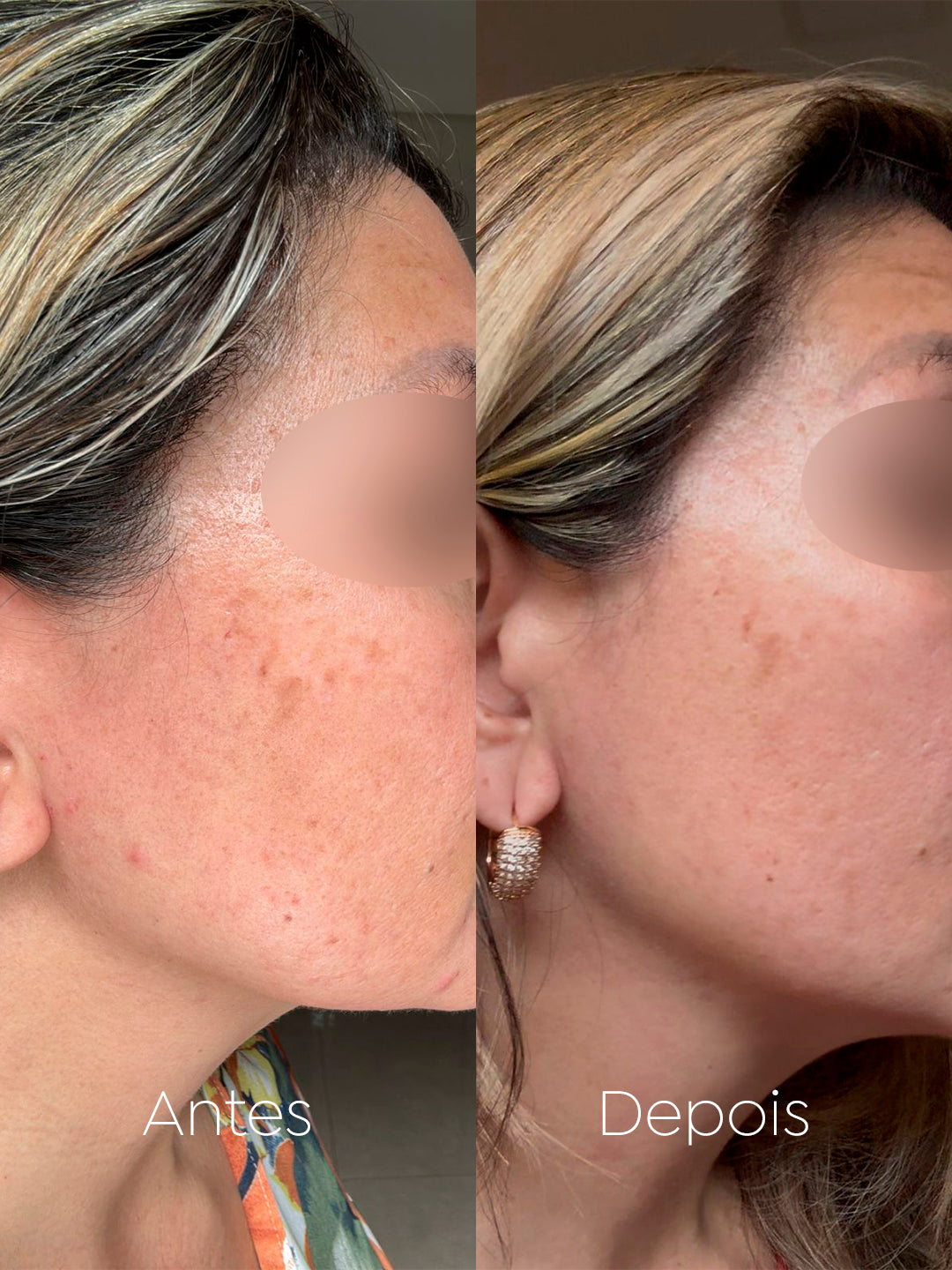 Sérum Facial Clareador e Antirugas