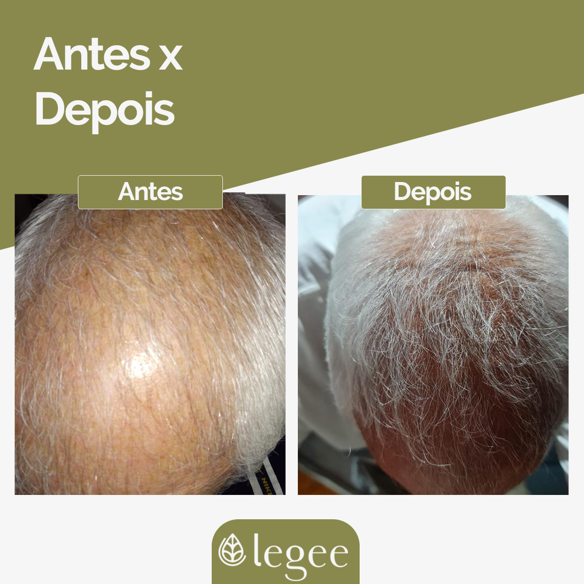 Spray Capilar 100 Queda