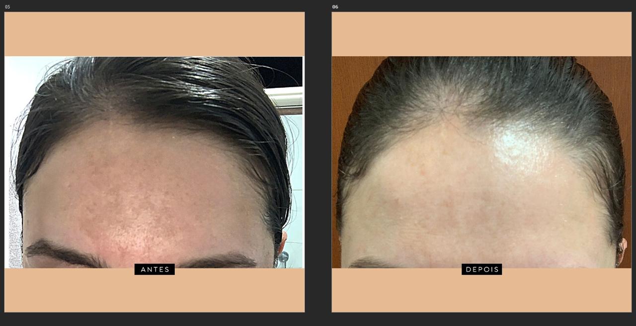 Sérum Facial Clareador e Antirugas