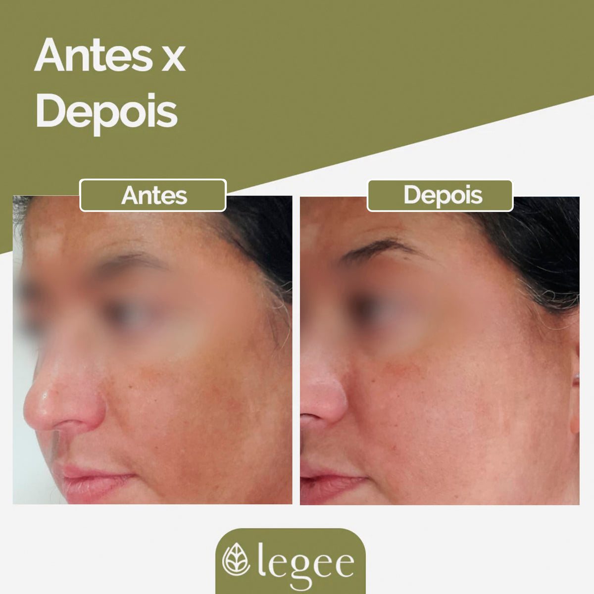 Sérum Facial Clareador e Antirugas