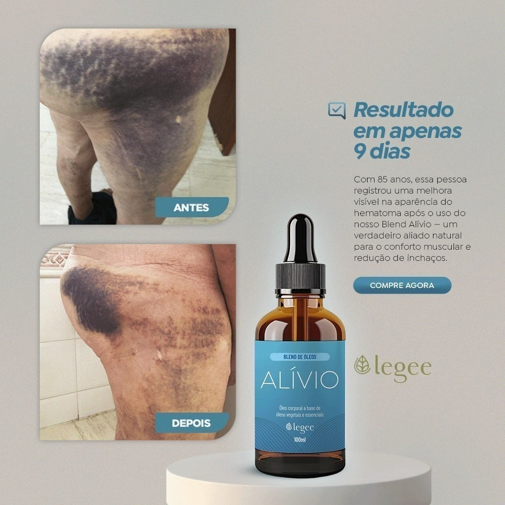 Alívio - 30mL